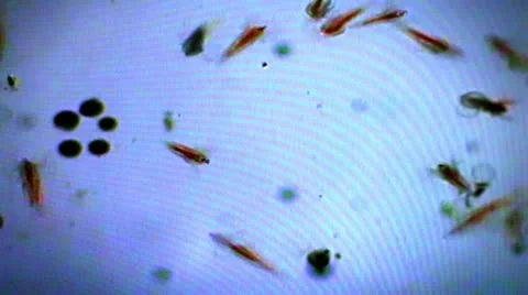 Plankton colorized Stock Footage 10584799