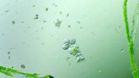 Plankton rotifers under the microscope   100x magnification Stock Footage 313143527