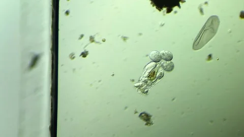 Plankton rotifers under the microscope Stock Footage 313143828