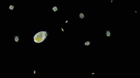 Plankton under a microscope, video: ciliates Bursaria, Halteria sp., Algae Stock Footage 130252526