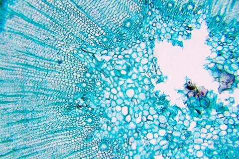 Plant cells Foto stock