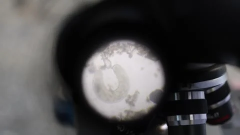 Plant Nematodes in a Microscope Stockbeeldmateriaal 311489372