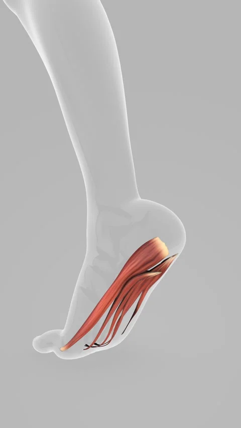 Plantar Fascia Tissue Overload Dysfunction Disorder Stock-Footage 282201449
