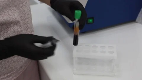 Plasma Stock Footage 126066166