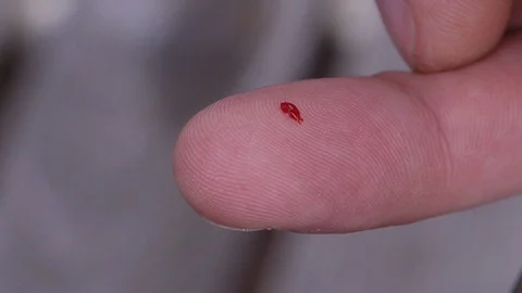 Plast stitches strap wrap Video stock 104779414