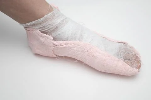 Plaster cast on the leg on a floor Stock Photos