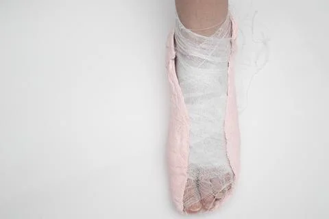 Plaster cast on the leg on a white background. Stock-Fotos