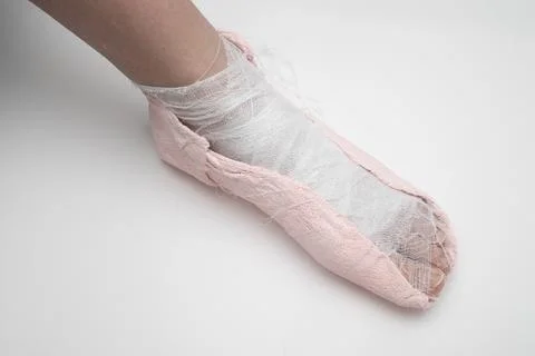 Plaster cast on the leg on a white background. Stock Photos