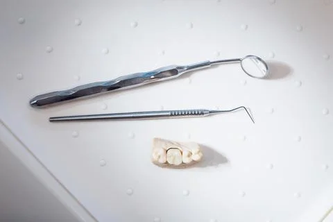 Plaster cast of teeth, tooth explorer and dental mirror Stock Photos