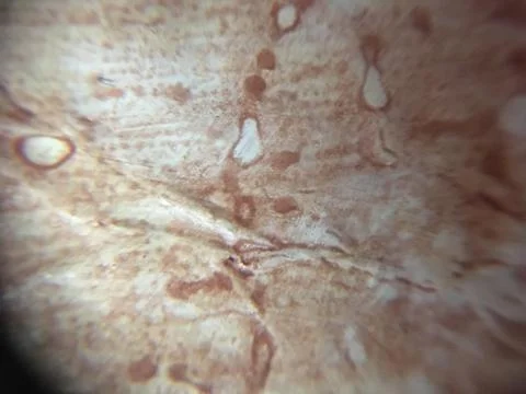 Plaster covering Stock Photos