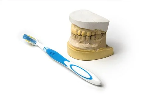 Plaster Dental Impression Cast Model with Blue Toothbrush Isolated on White Stock Photos