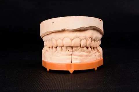 Plaster dental mold Stock Photos