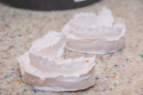 Plaster impression of teeth. Dental plaster mold. Dental mold showing teeth on a Stock Photos