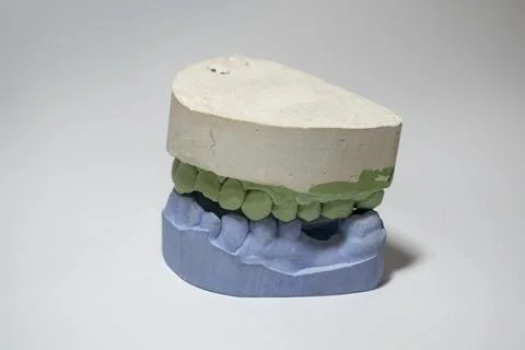 Plaster impressions of the teeth of the lower and upper jaws for prosthetics and Stock Photos