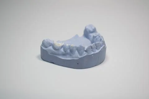 Plaster impressions of the teeth of the upper jaws for prosthetics and Stock Photos