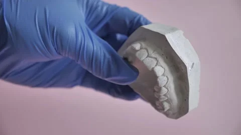 Plaster model of the impression of the upper dental jaw Video stock 144777839