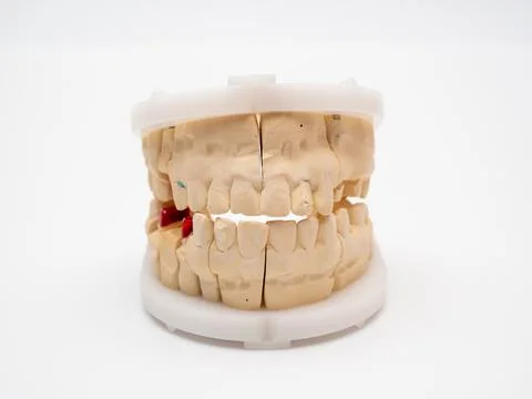 Plaster model or cast of human teeth. Stock Photos
