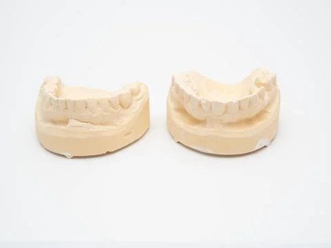 Plaster model or cast of human teeth. Stock Photos