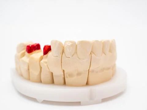 Plaster model or cast of human teeth. Stock Photos