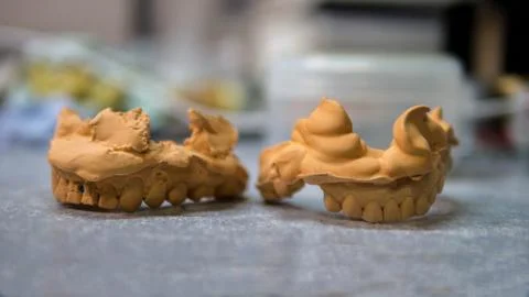 Plaster model of teeth on a work table,a dental technician makes a prosthesis Stock Photos
