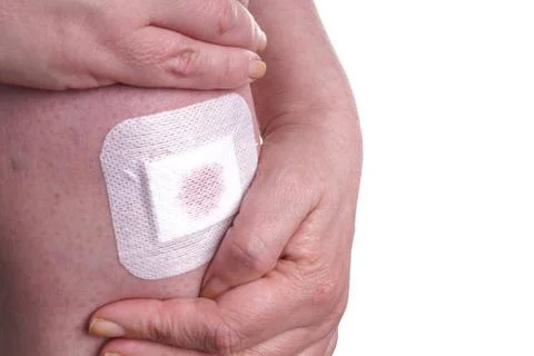 Plaster on a Womans Knee Stock Photos