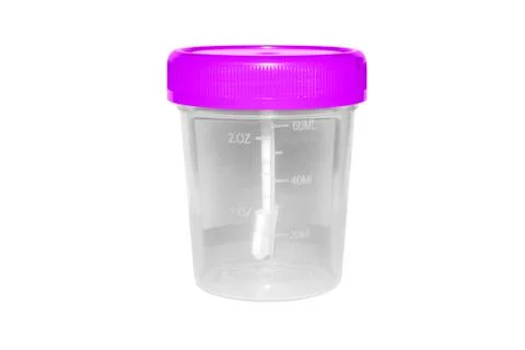 Plastic container for urine analysis isolated on white background. Stock Photos