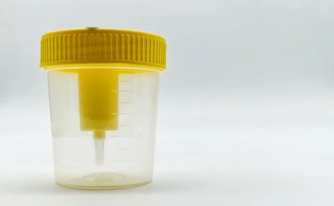 Plastic container for urine with yellow cap isolated on white background Stock-Fotos