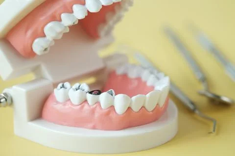 Plastic dental teeth model on white background Stock Photos