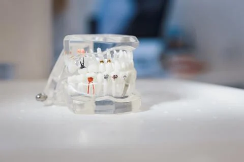 Plastic jaws model on table Stock Photos