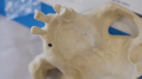 Plastic layout of the human jaw. Stock-Footage 95859205