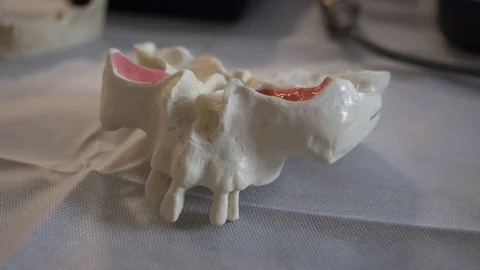 Plastic layout of the human jaw. Vídeo Stock 95859309