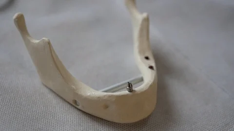 Plastic layout of the human jaw. Vídeo Stock 95859647