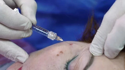 Plastic surgeon doing anti-aging injections. Close-Up a face Stock Footage 75446758