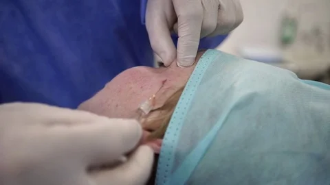 Plastic surgeon doing anti-aging injections. Close-Up Stock Footage 75447685