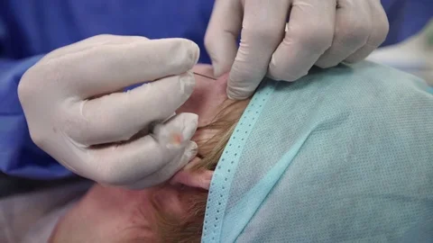 Plastic surgeon doing anti-aging injections Stock Footage 75447855