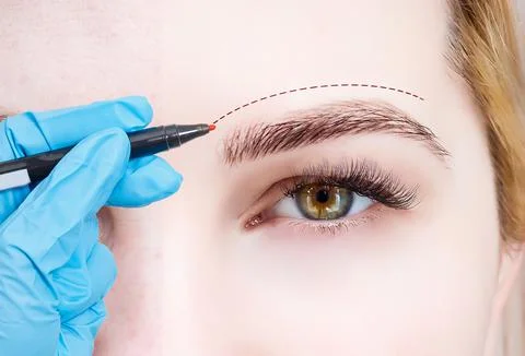 Plastic surgeon drawing dashed line under eye of girl. Hand in blue glove Foto stock
