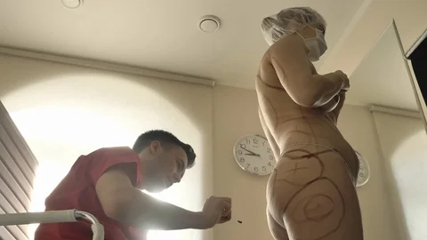 A plastic surgeon draws a markup for the operation of liposuction and Видео 90800395