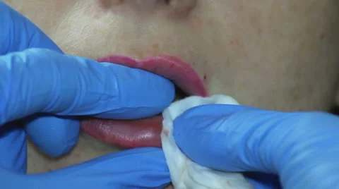 A Plastic Surgeon Stock Footage 65989747