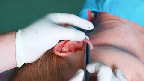 A plastic surgeon makes marks on a woman's face, marks on her ears, preparing Stock Footage 230154882
