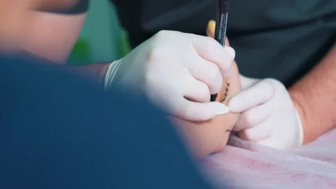 A plastic surgeon marks a woman's hand in preparation for plastic surgery. Stock Footage 230154840
