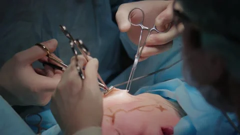 Plastic surgeon performs facelift surgery 動画素材 148046926