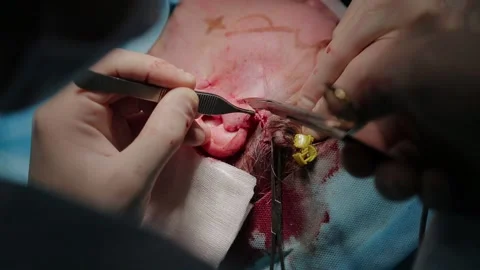 Plastic surgeon performs facelift surgery 動画素材 148047212