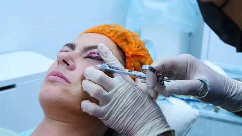 The plastic surgeon puts an injection in the patient eye. Plastic surgery Stock Footage 145602629
