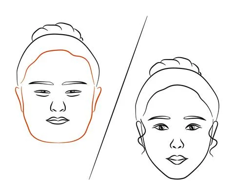 Plastic surgery. Before and after. Stock Illustration
