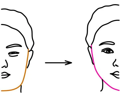 Plastic surgery. Before and after. Vector illustration. Stock Illustration