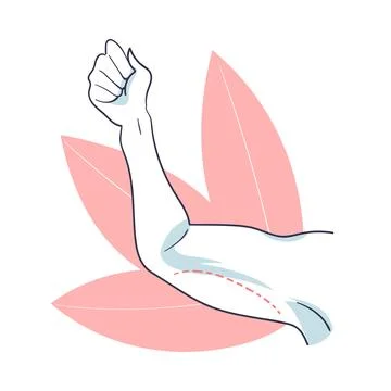Plastic Surgery with Arm Body Part Correction in Aesthetic Beauty Clinic Vector Stock Illustration