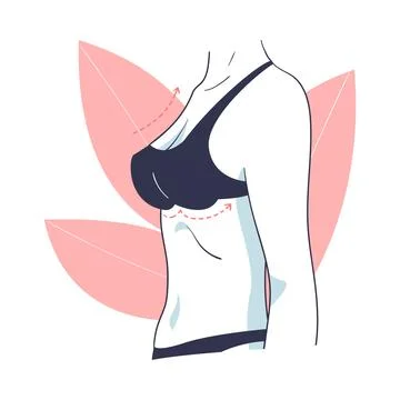 Plastic Surgery with Breast Body Part Correction in Aesthetic Beauty Clinic Stock Illustration
