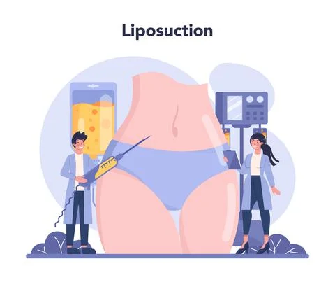 Plastic surgery concept. Idea of body correction. Liposuction Illustrazione stock