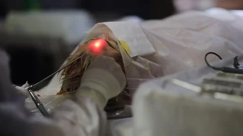 Plastic surgery endoscopic facelift in the operating room Stock Footage 246554255