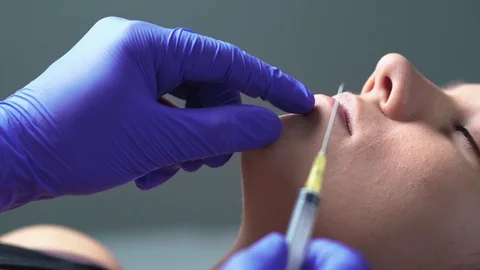 Plastic surgery, lip injection and augmentation or beauty treatment concept. Stock Footage 123771911